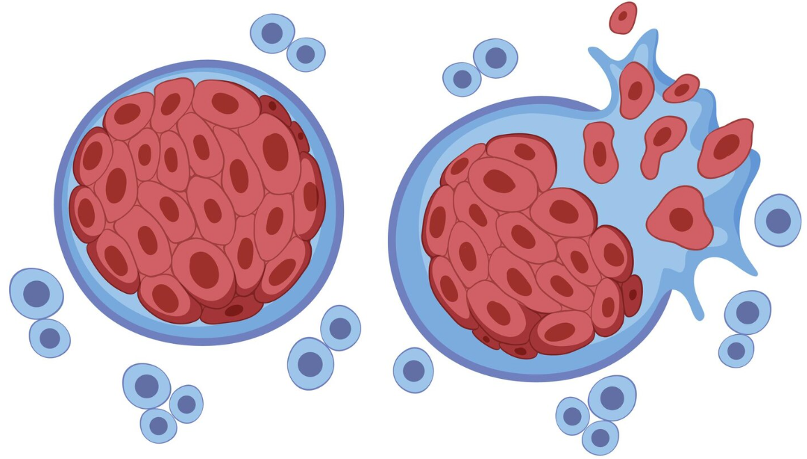 CONVEGNO - RETE ONCOLOGICA REGIONALE: STRATEGIE E STRUMENTI PER UN'ASSISTENZA UNIFORME NEL LAZIO